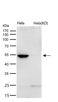 Glutathione Synthetase Rabbit mAb [KD Validated]