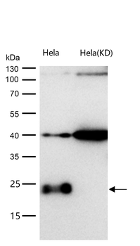 CBFb Rabbit mAb [KD Validated]
