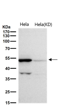 PIST Rabbit mAb