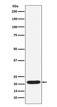 SOCS2 Rabbit mAb