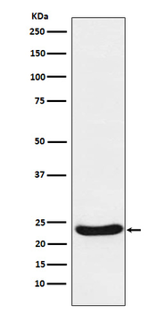 UQCRFS1 Rabbit mAb