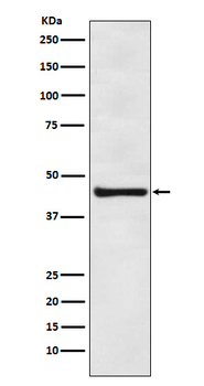 eIF4A3 Rabbit mAb