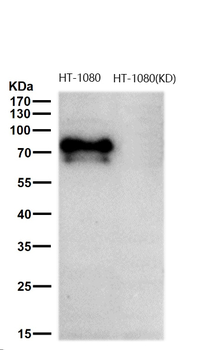 DCP1A Rabbit mAb
