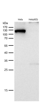 HAUSP / USP7 Rabbit mAb [KD Validated]