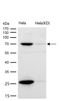 RPA70 Rabbit mAb [KD Validated]