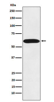 STIP1 Rabbit mAb