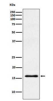 gamma Synuclein Rabbit mAb
