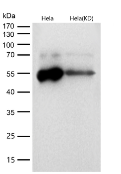 LOXL2 Rabbit mAb  [KD Validated]