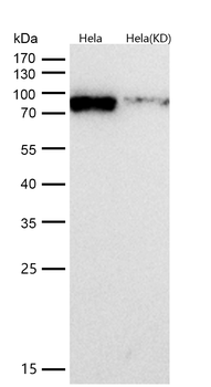 KAT7 / HBO1 / MYST2 Rabbit mAb [KD Validated]