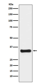 Thymidylate Synthase Rabbit mAb