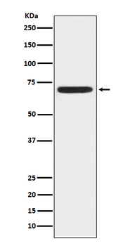 ZAP70 Rabbit mAb
