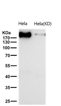 GCN2 Rabbit mAb