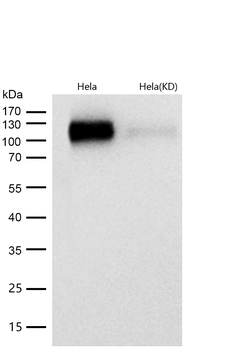 Integrin alpha V Rabbit mAb [KD Validated]