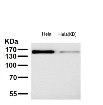 Drosha Rabbit mAb