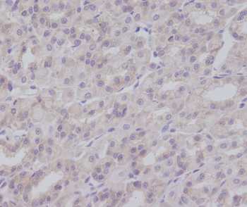 IKK gamma Rabbit mAb