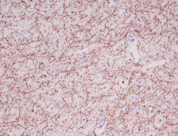 Myelin Basic Protein Rabbit mAb