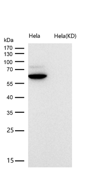 E2F1 Rabbit mAb [KD Validated]