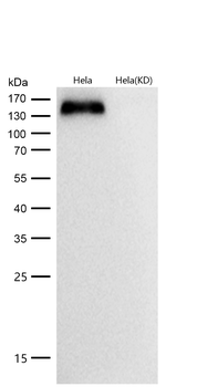 Integrin alpha 5 Rabbit mAb [KD Validated]