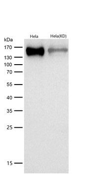 HDAC4 Rabbit mAb [KD Validated]