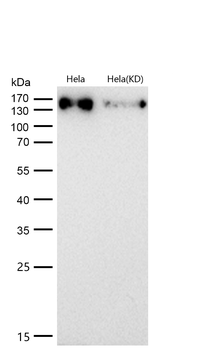 HDAC9 Rabbit mAb [KD Validated]