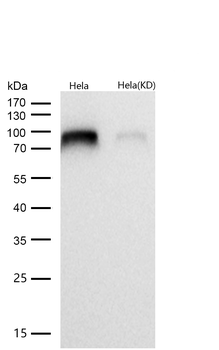 IKK alpha Rabbit mAb [KD Validated]