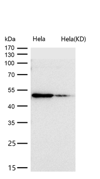 ADIPOR1 Rabbit mAb [KD Validated]