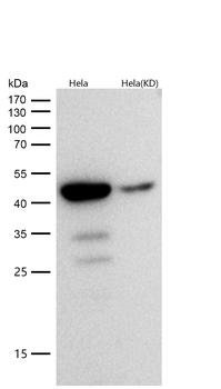 cleaved Caspase-9 Rabbit mAb [KD Validated]