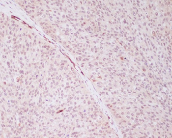 PRP19 Rabbit mAb