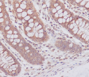 ATG7 Rabbit mAb