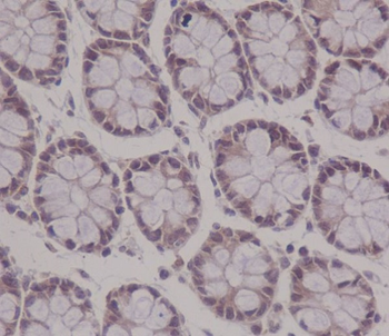 APC Rabbit mAb