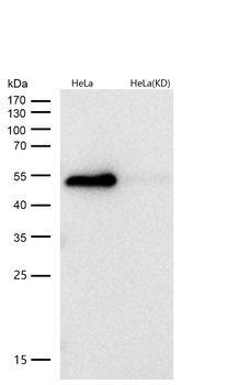 GAP43 Rabbit mAb [KD Validated]