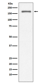 CD11a Rabbit mAb