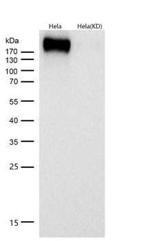 Tuberin Rabbit mAb  [KD Validated]