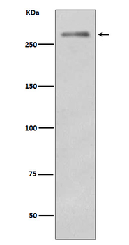 Dysferlin Rabbit mAb