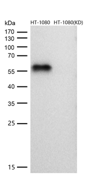 Smad2 Rabbit mAb [KD Validated]