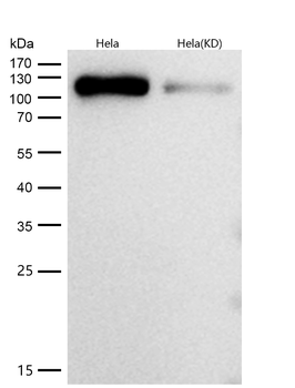 Daxx Rabbit mAb [KD Validated]