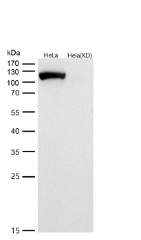 ATP citrate lyase Rabbit mAb  [KD Validated]