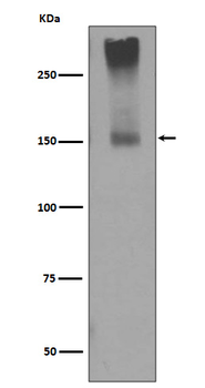 GRM5 Rabbit mAb