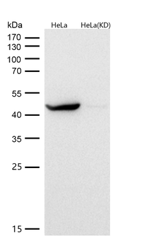 PGK1 Rabbit mAb  [KD Validated]