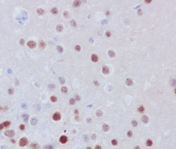 Fos B Rabbit mAb
