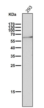 ELK1 Rabbit mAb