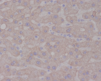TrkA Rabbit mAb