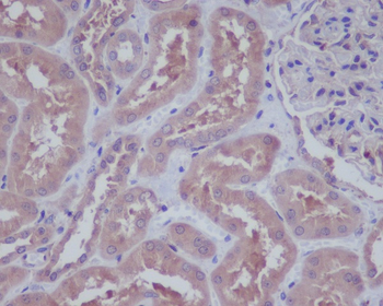 HAPLN1 Rabbit mAb