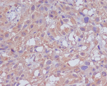Neuropilin 1 Rabbit mAb