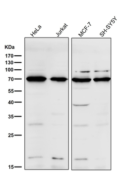CD86 Rabbit mAb