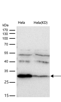 BDNF Rabbit mAb   [KD Validated]