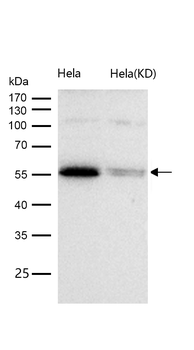 HDAC1 Rabbit mAb [KD Validated]