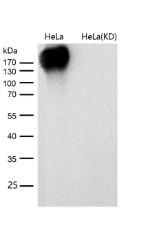 EGFR (ErbB 1) Rabbit mAb [KD Validated]
