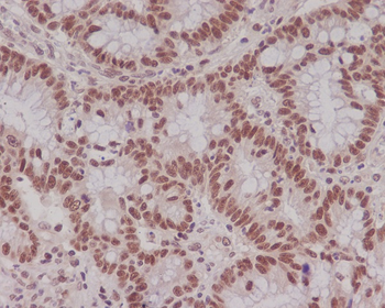 MLH1 Rabbit mAb
