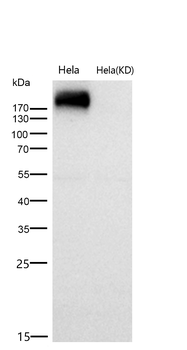 EGFR Rabbit mAb [KD Validated]